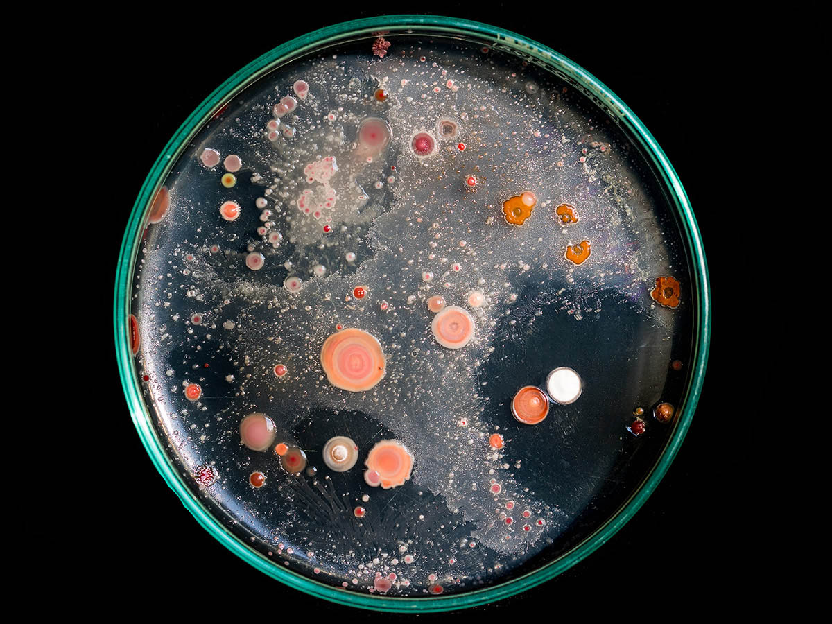 Clear Petri Dish with Red spots on a Black Background - Biomedical Science Degree Header