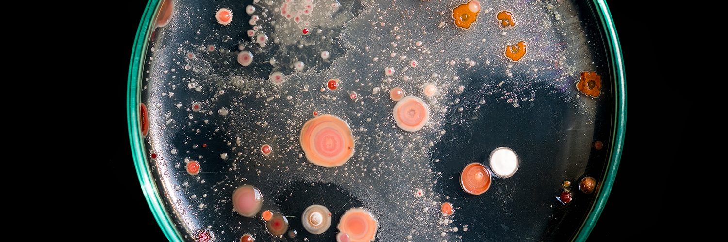 A petra dish close-up