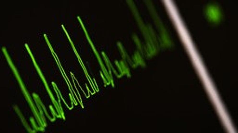 Heart monitor screen