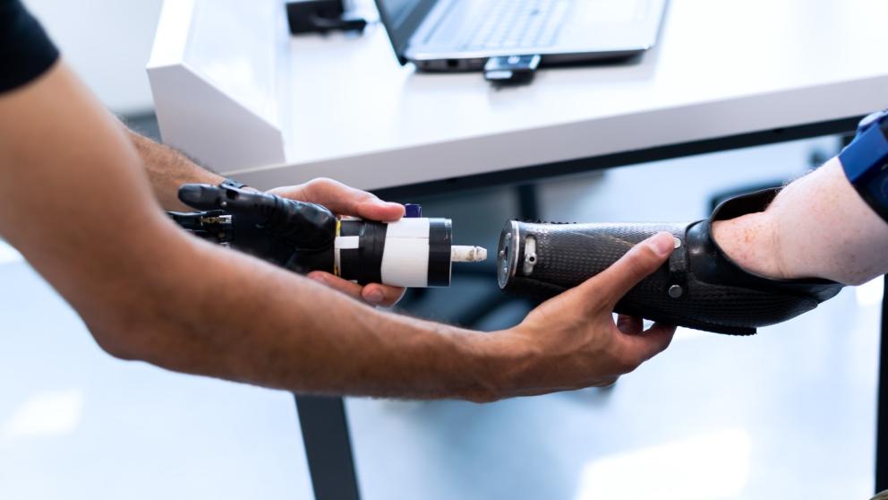 A prosthetic arm is assembled