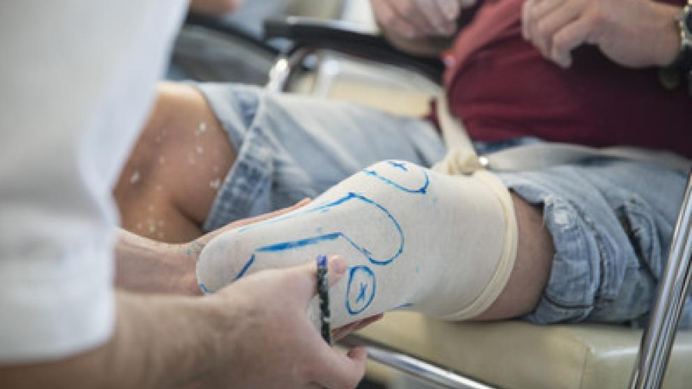 Close up of cast being fit below the knee