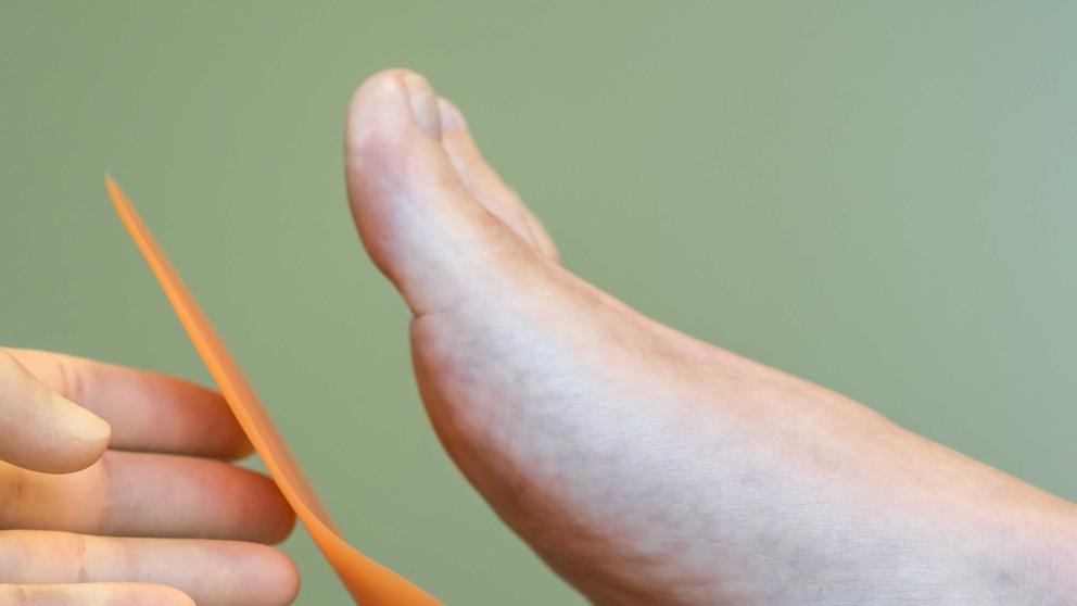 Someone getting podiatry treatment 