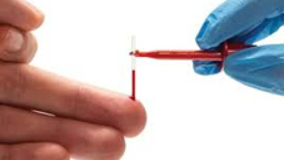 Fingerstick blood sampling