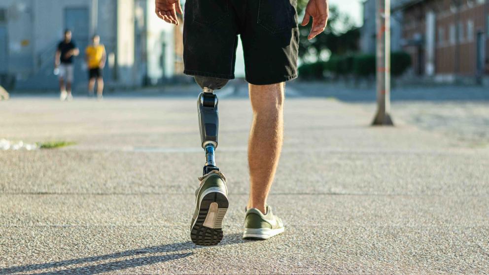 Prosthetic limb user walking 