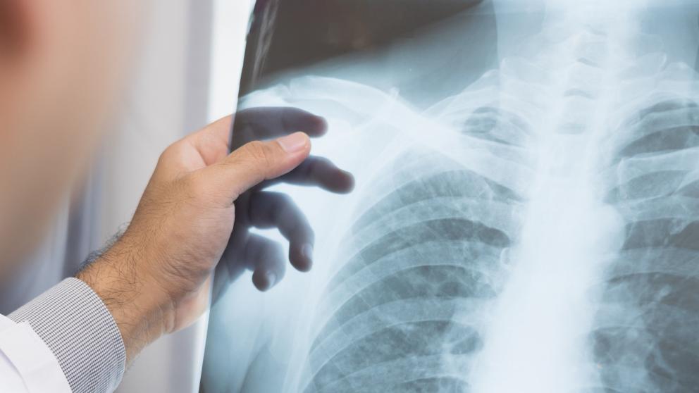 Medical staff holding a chest and lung x-ray