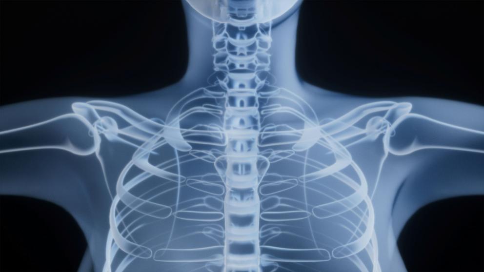 A scan image of a torso