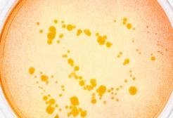 Bacterial colonies growing on an agar plate