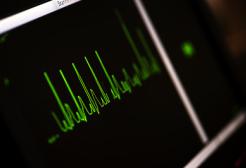 Heart monitor screen