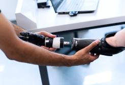 A prosthetic arm is assembled