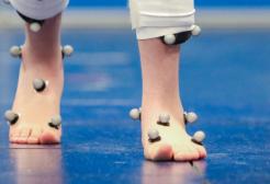 Gait Analysis banner