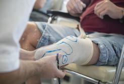 Student fitting a cast below the knee on an amputee