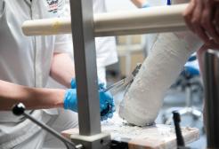 Medical student uses medical scissors to cut the cast off a patients leg. 