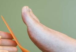 Someone getting podiatry treatment 