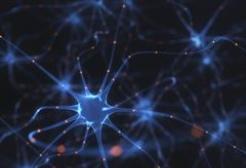 image shows neurological image under microscope 