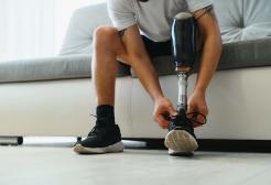 Prosthetic limb user sitting down 